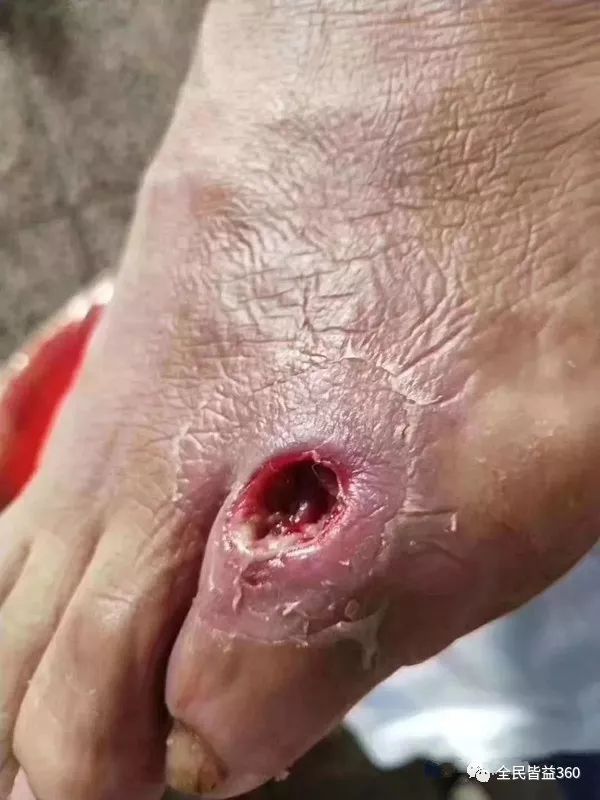 记住,巴克三剑客可以拿下90%的皮肤问题!