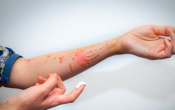 重磅推出 :"巴克三剑客" |  能可靠解决90%以上的皮肤问题 !